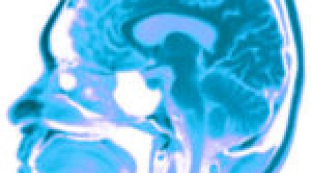 brain11-150x150-1
